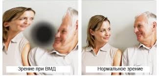 Линзы для глаз цветные вредно ли это если зрение хорошее