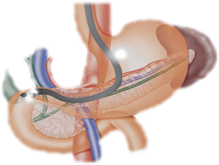 endoscop