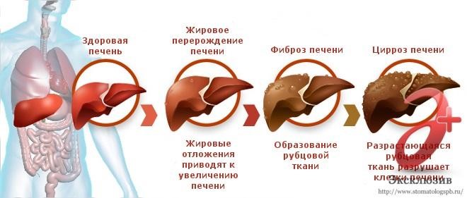 вред алкоголя 2