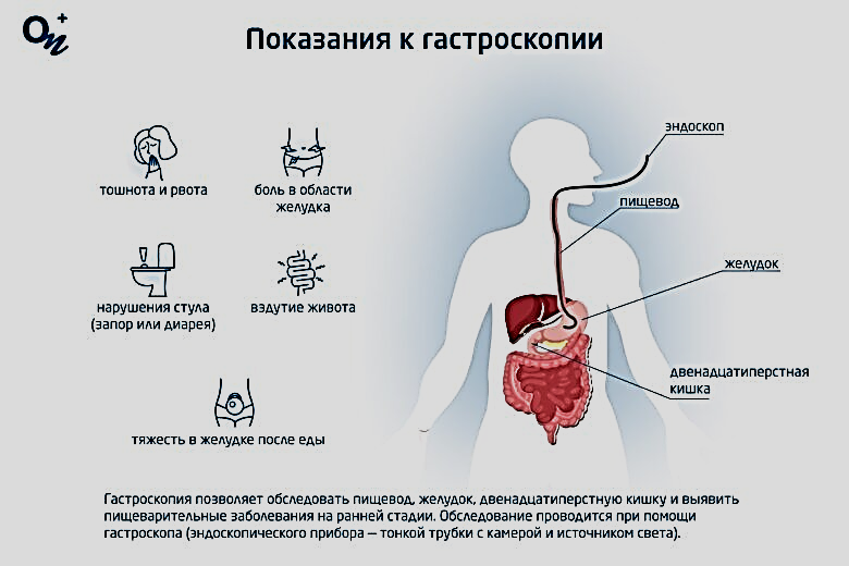 подготовка к гастроскопии 3