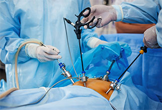 Рентгенэндоваскулярная хирургия